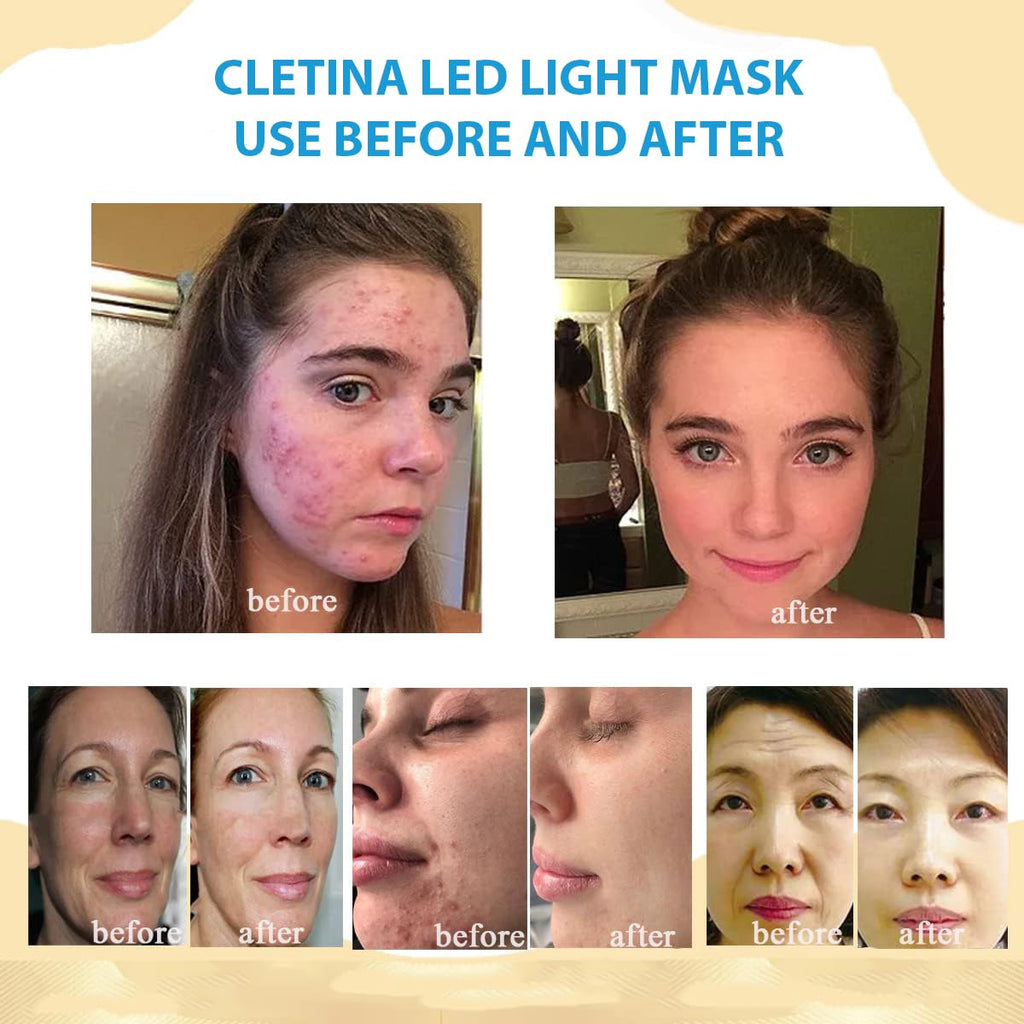 7 Colors LED Face Mask I79873