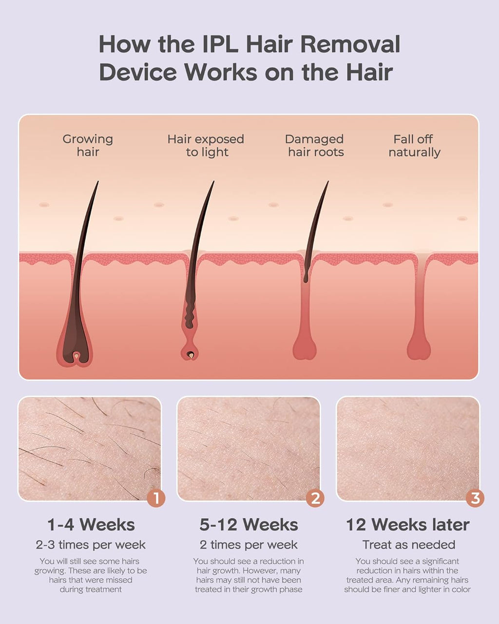 999,000 Flashes IPL Hair Removal Device Z74784