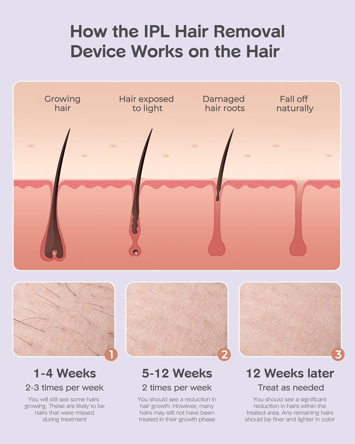 999,000 Flashes IPL Hair Removal Device Z74784